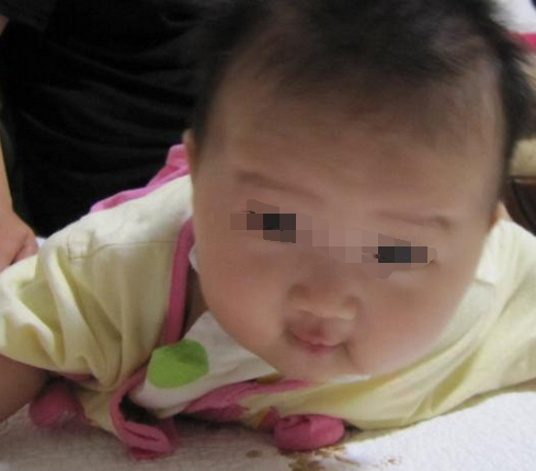 小儿脑瘫应该怎么治疗呢