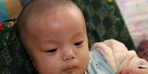 患了脑瘫会带来哪些危害呢