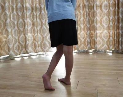 为什么脑瘫会多发