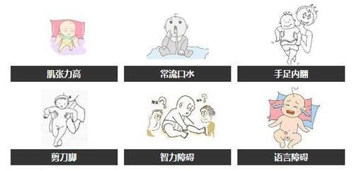 孩子脑瘫有哪些表现